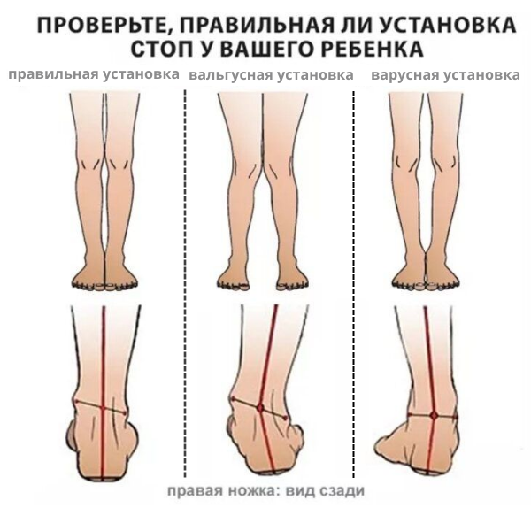 правильная установка.png правильная установка.png