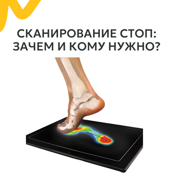 сканирование стоп 600 на 600.png