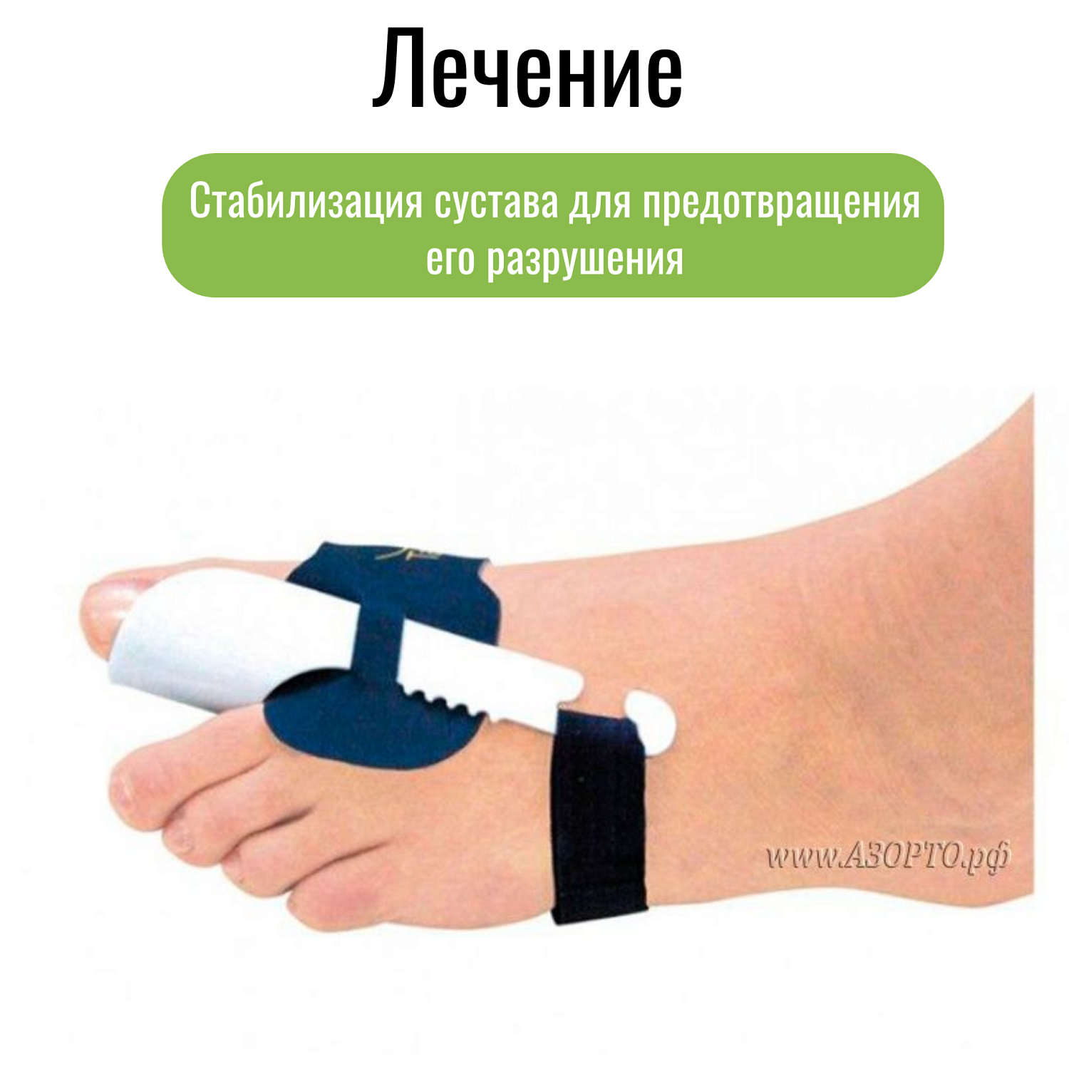 Подагра: что это за заболевание, как его распознать и какие ортопедические приспособления помогут облегчить симптомы  